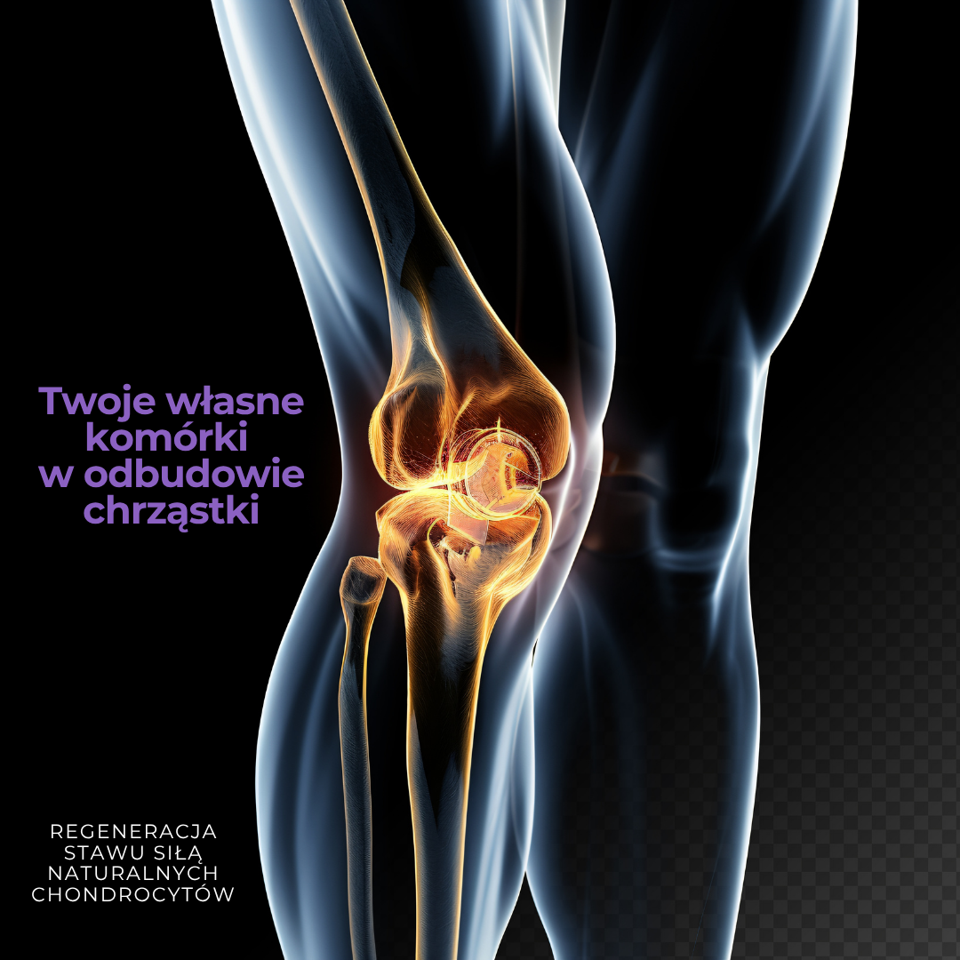 Wizualizacja stawu kolanowego w technice 3D z przezroczystym obrazem kości i podświetloną na pomarańczowo chrząstką. Obok widoczny napis: „Twoje własne komórki w odbudowie chrząstki” oraz „Regeneracja stawu siłą naturalnych chondrocytów”